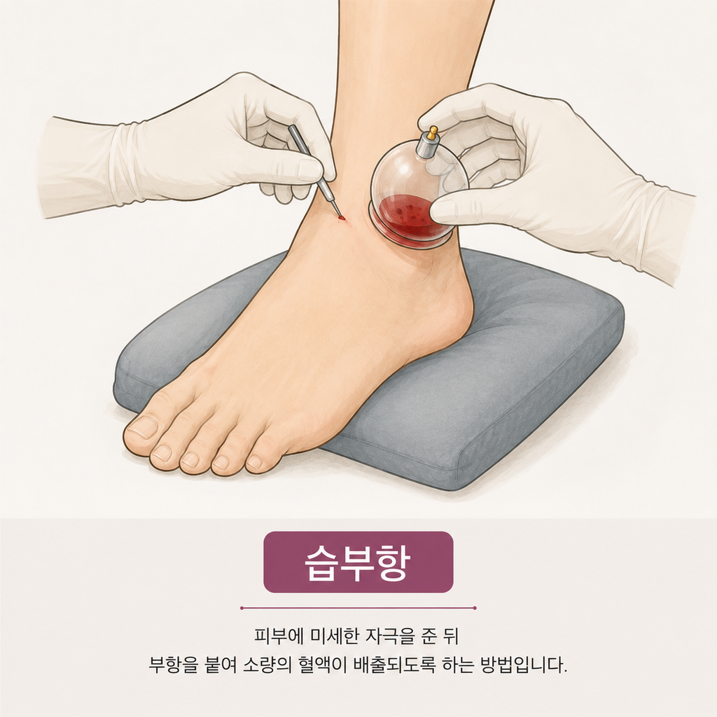 발목에 습부항을 하는 그림